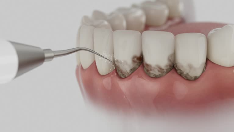 Reliable Dental Implants contractor in San Manuel, AZ by Smile Center Dentistry